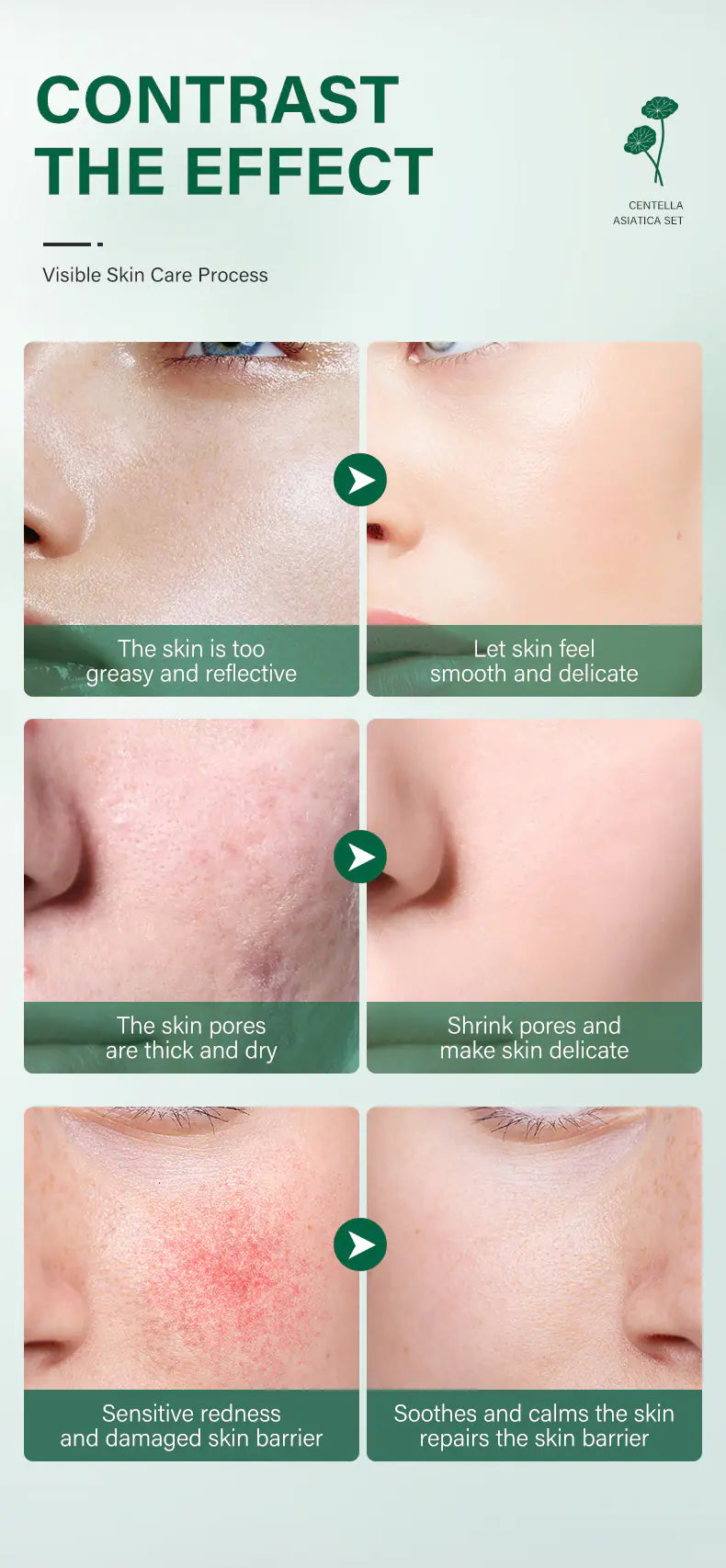 ✨ Set de Cuidado Facial de Centella Asiática – 5 Piezas para Hidratación, Calma y Renovación Total