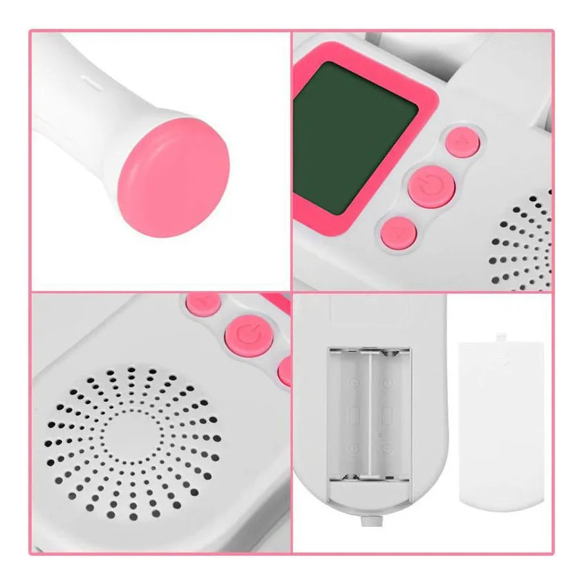 ALBEZON® HEARTGUARD™ BABY – Monitor de Frecuencia Cardíaca para Bebés | Tranquilidad Real, Día y Noche