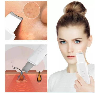 ALBEZON® PURESONIC™ – Limpiador Ultrasónico Facial Profesional | Piel Limpia, Suave y Radiante